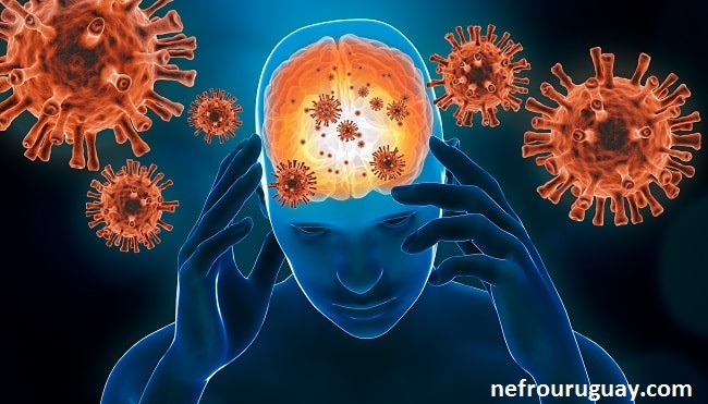 9 Gejala Neurologis & Kemungkinan Penyebabnya